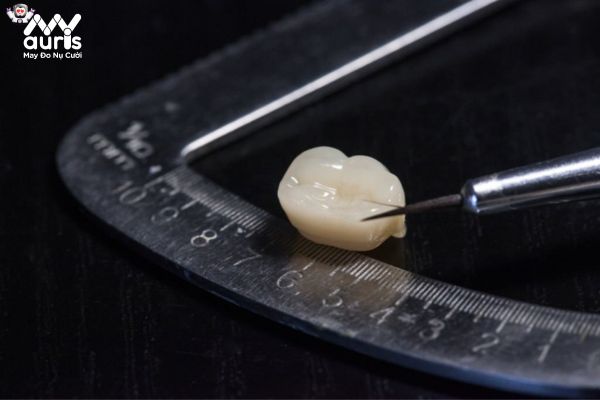 Chi phí làm răng sứ trọn gói có thể bị ảnh hưởng từ những yếu tố nào?