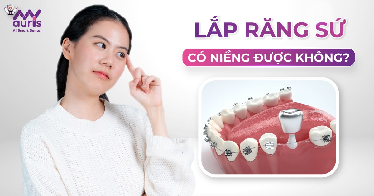 Lắp răng sứ có niềng răng được không? (Xem xét 4 yếu tố)