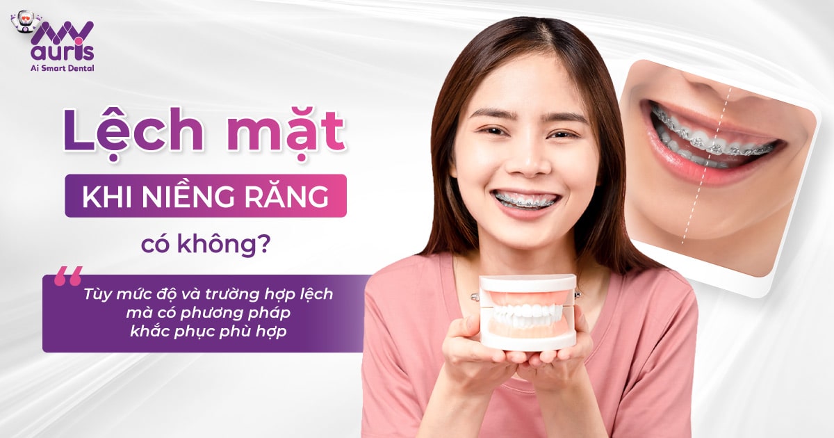 Lệch mặt khi niềng răng có không