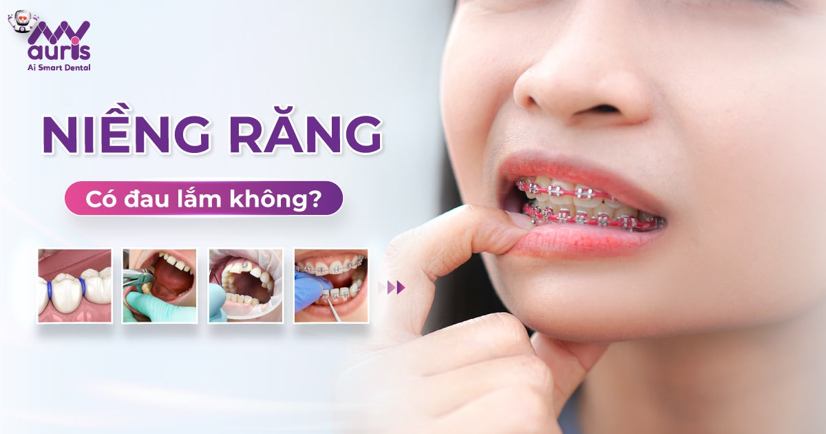 Niềng răng có đau lắm không - 4 giai đoạn cần chú ý