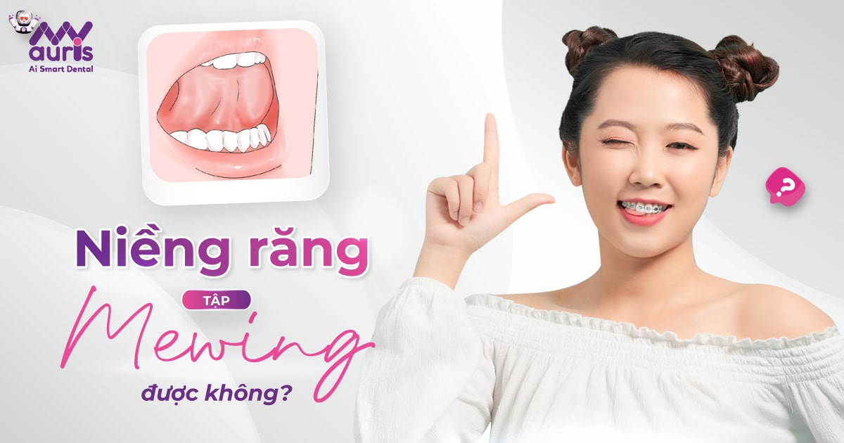 Niềng răng có tập Mewing được không? 2 bước thực hiện