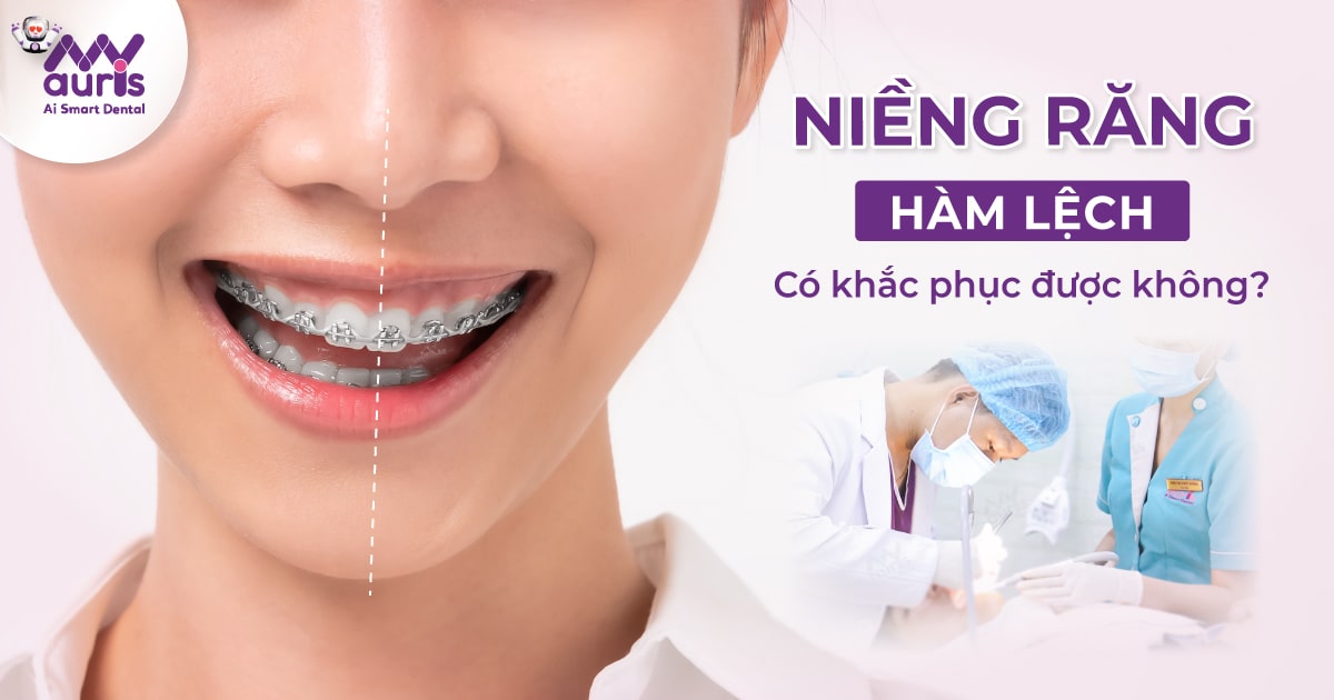 Niềng răng hàm lệch có khắc phục hàm lệch hiệu quả không?