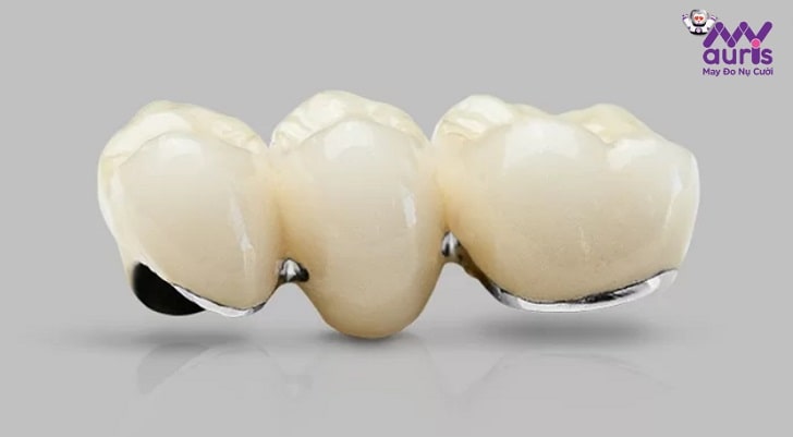 răng sứ kim loại ceramco iii