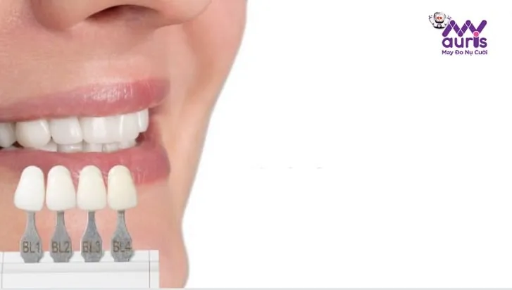 răng sứ kim loại vita