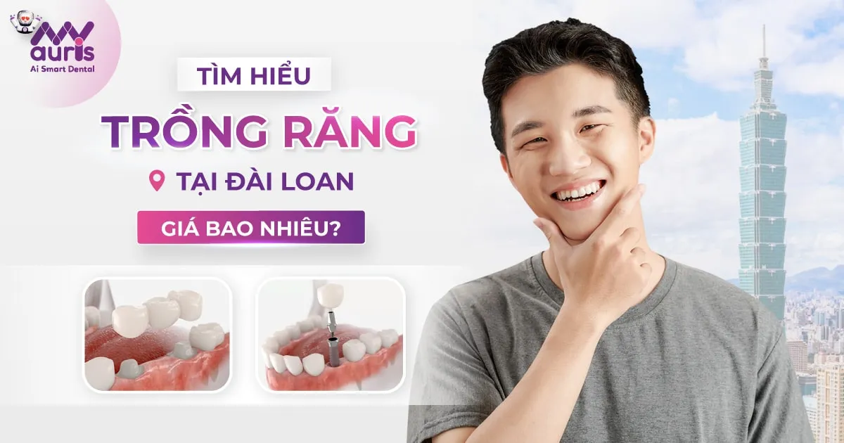 Tìm hiểu trồng răng tại đài loan giá bao nhiêu?
