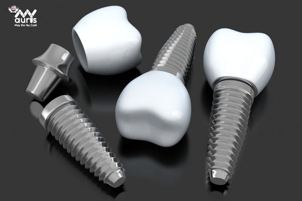 Vì sao trồng răng implant giữ được lâu hơn so với các phương pháp khác? 