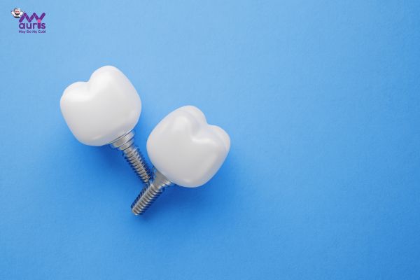 Chất lượng răng giả - Có nên trồng răng ở Nhật không? 
