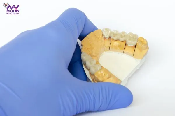 Trồng răng sứ là gì? 