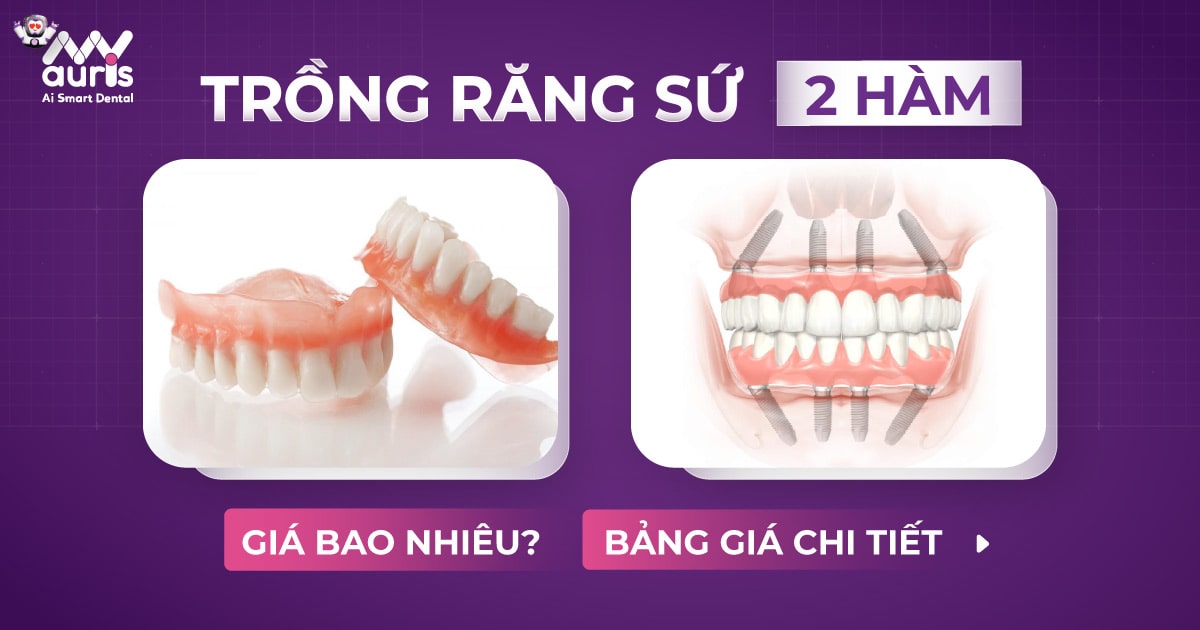 Trồng răng sứ 2 hàm giá bao nhiêu