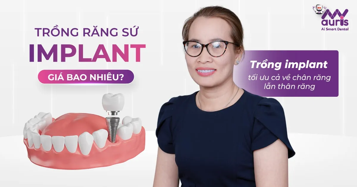 Trồng răng sứ implant giá bao nhiêu