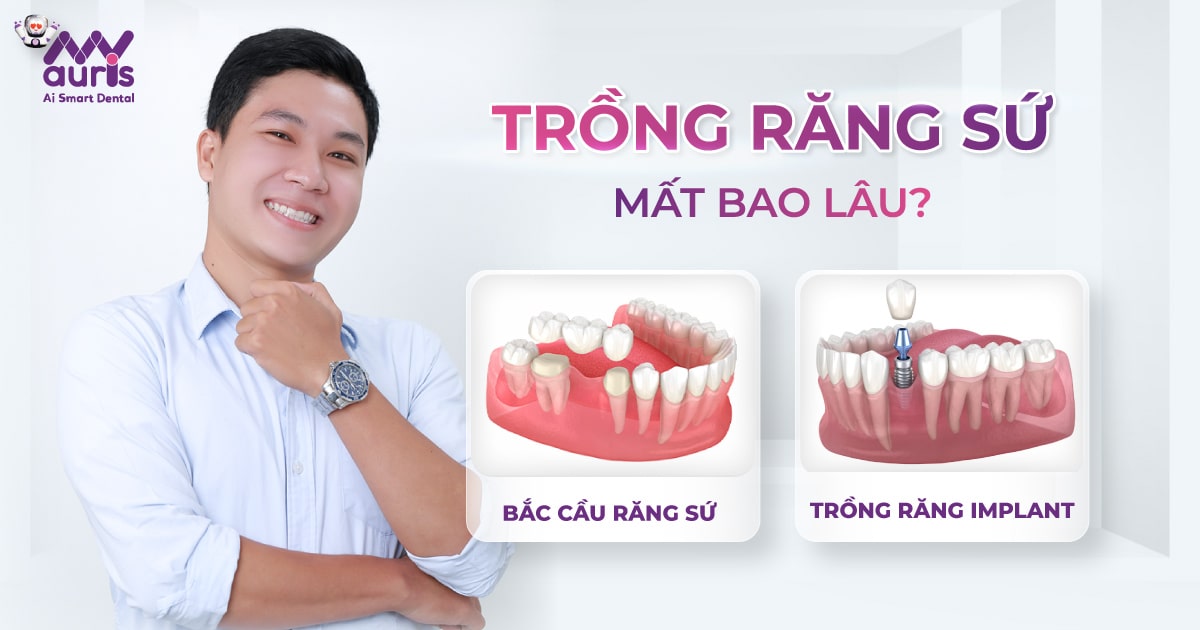 Trồng răng sứ mất bao lâu? 2 phương pháp chính