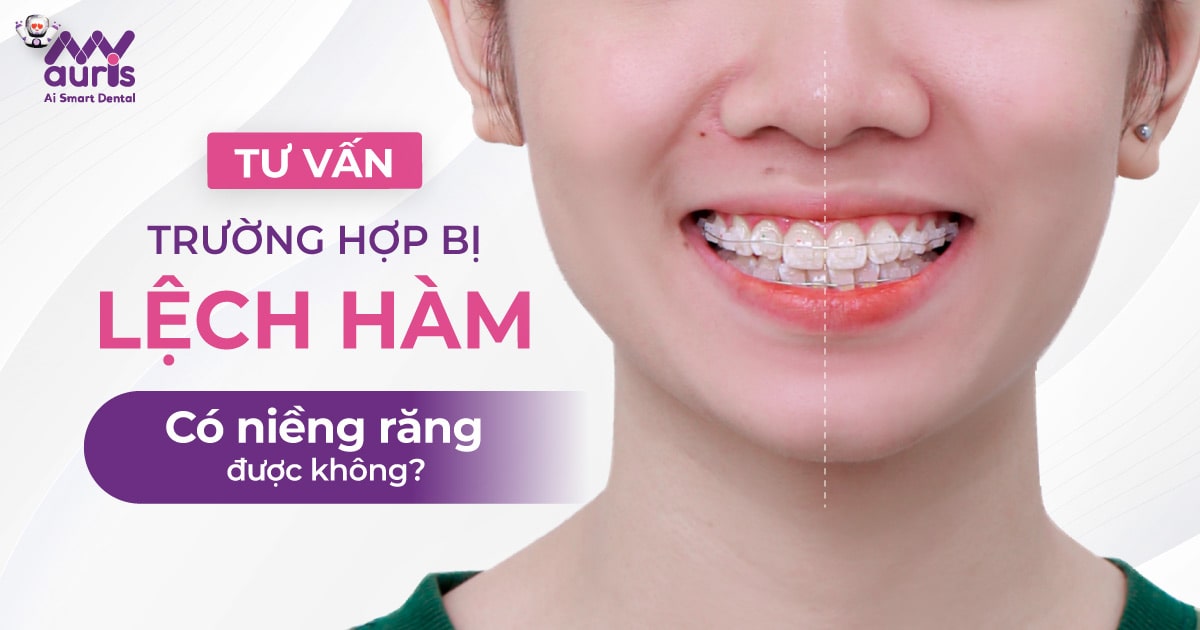 Tư vấn trường hợp bị lệch hàm có niềng răng được không?