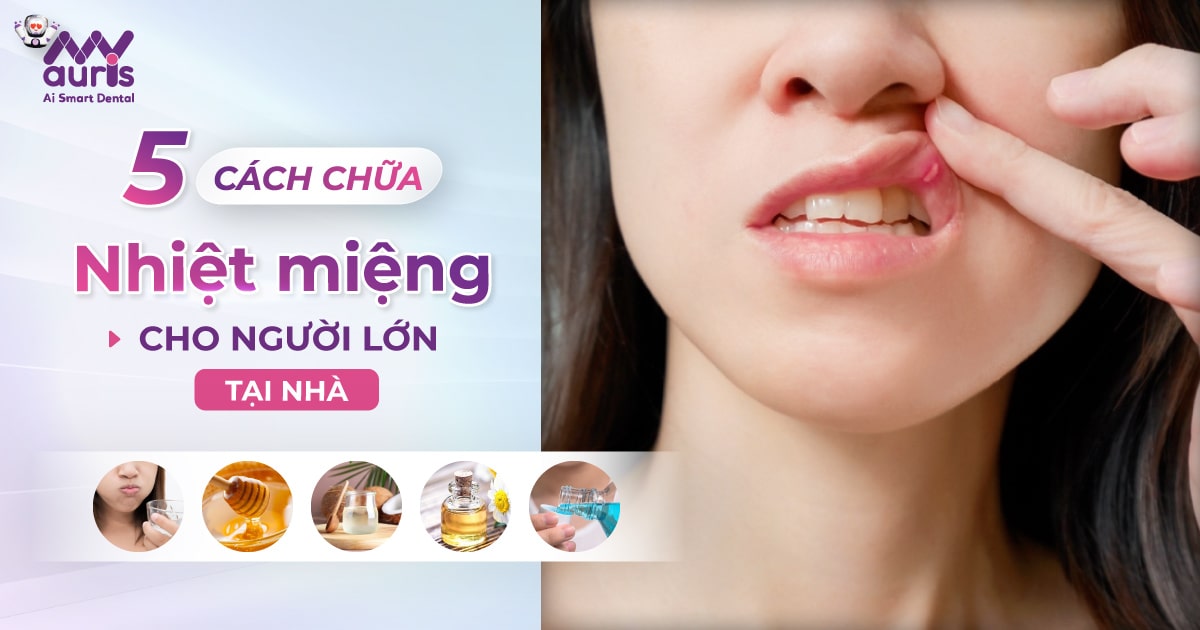 5 cách chữa nhiệt miệng cho người lớn tại nhà