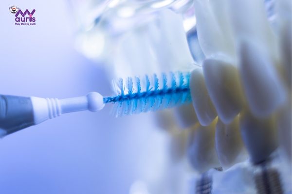 vệ sinh răng miệng sau khi trồng răng implant