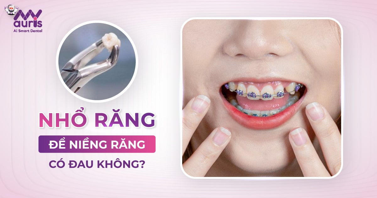 nhổ răng để niềng răng có đau không