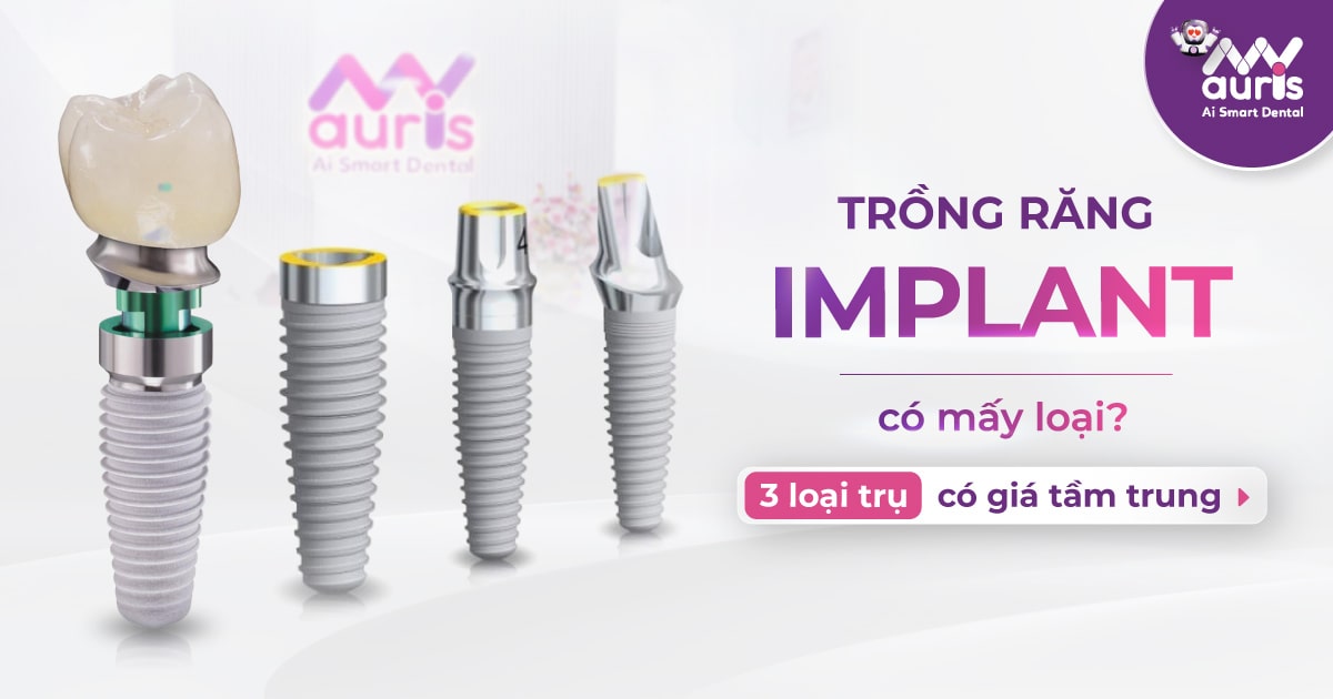 trồng răng implant có mấy loại