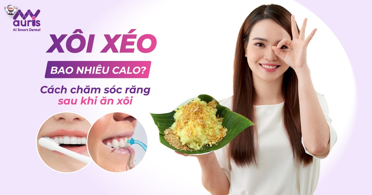 xôi xéo bao nhiêu calo