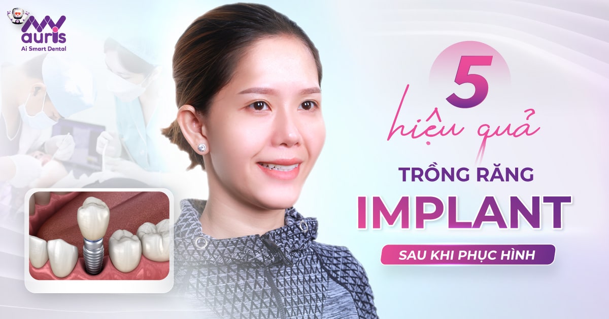 hiệu quả trồng răng implant