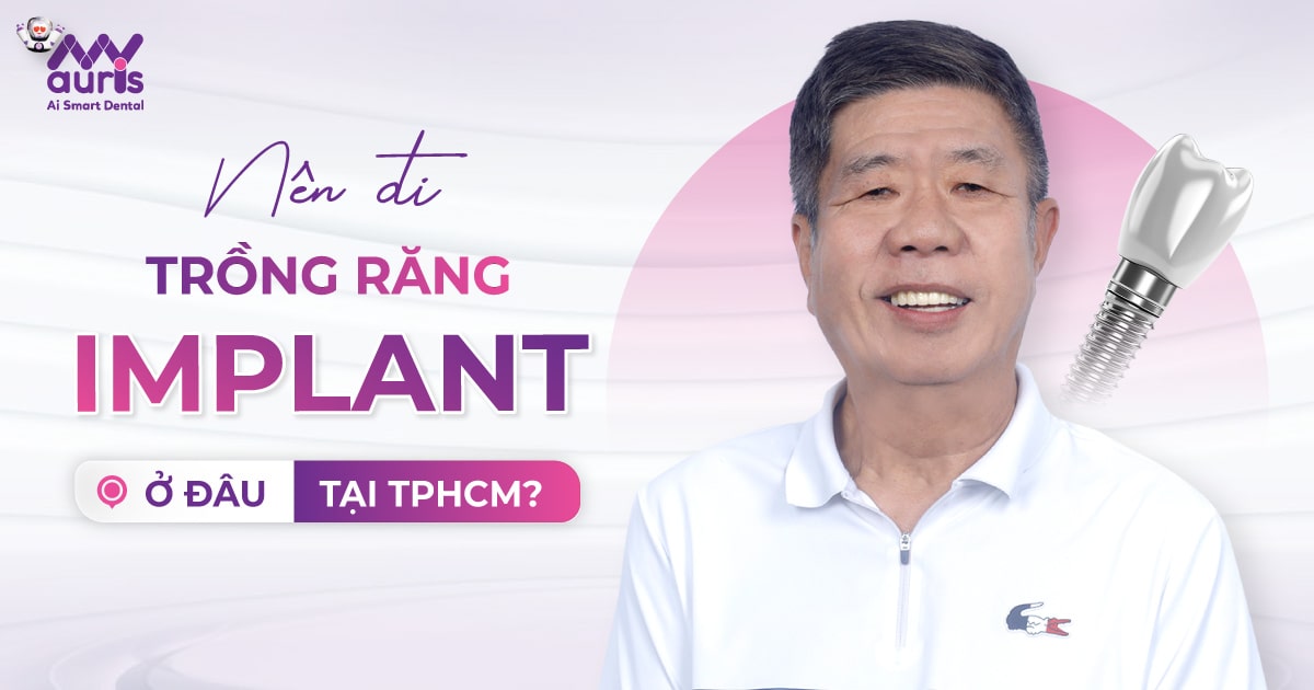 nên đi trồng răng implant ở đâu