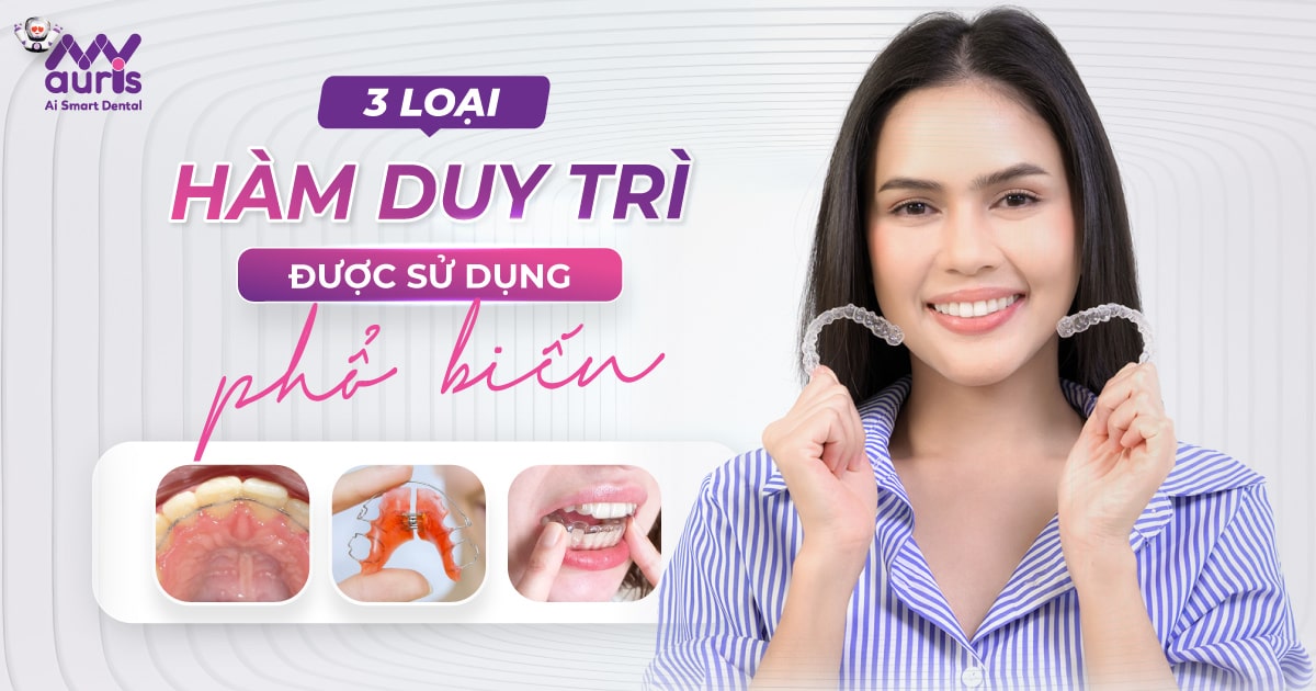 hàm duy trì niềng răng