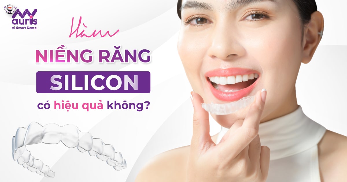 hàm niềng răng silicon