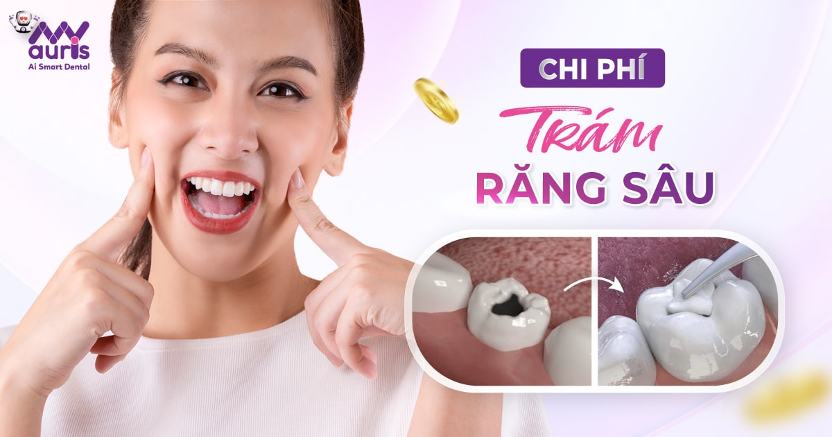 trám răng sâu bao nhiêu tiền