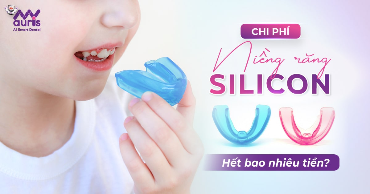 giá tiền niềng răng hiện nay