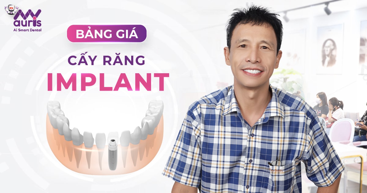 Bảng giá cấy răng Implant - 4 cách tối ưu chi phí