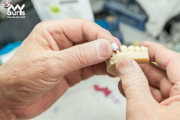 Giải đáp bọc răng sứ có cần phải mài răng không?