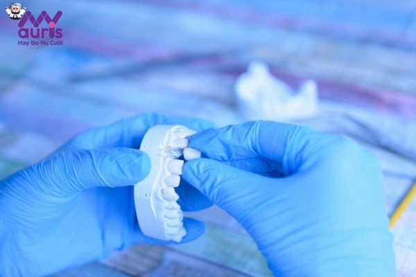 Khi nào cần thực hiện thay mới các mão răng sứ?