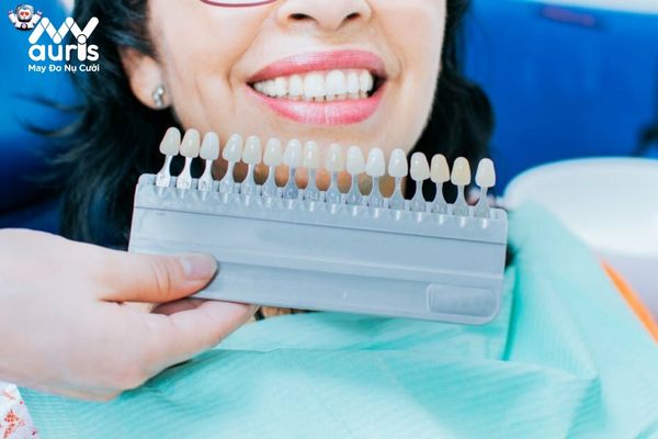 Tìm hiểu bọc răng sứ giữ được bao lâu?