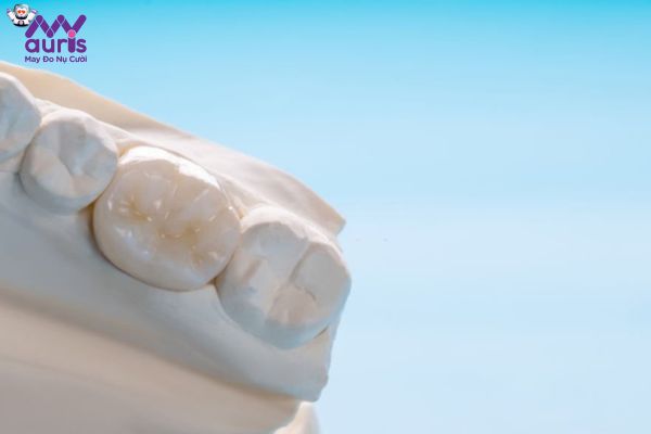Chi phí phục hình răng sứ toàn sứ