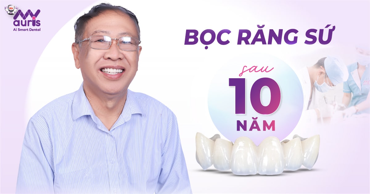 [Giải đáp] Bọc răng sứ sau 10 năm có cần làm lại?