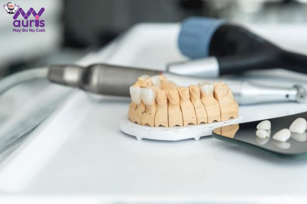 Bọc răng sứ có được áp dụng hình thức trả góp không?