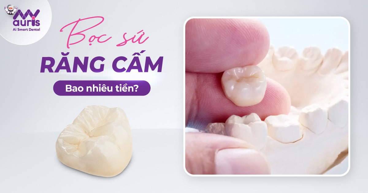 Bọc sứ răng cấm bao nhiêu tiền? (3 lợi ích chính)