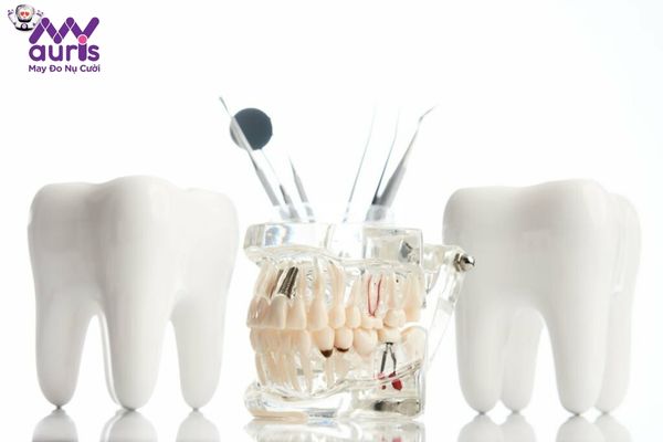 Nên thực hiện làm cầu răng sứ hay Implant thì tốt nhất?