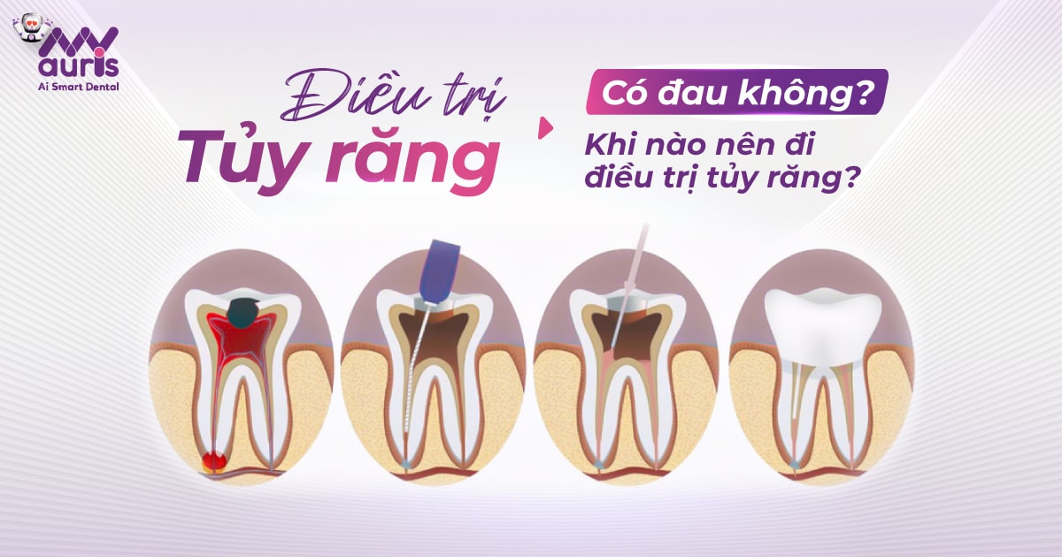 Điều trị tủy răng có đau không