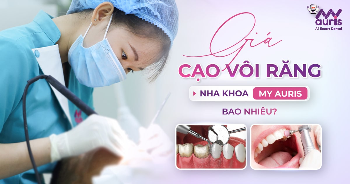 Giá cạo vôi răng nha khoa My Auris bao nhiêu?