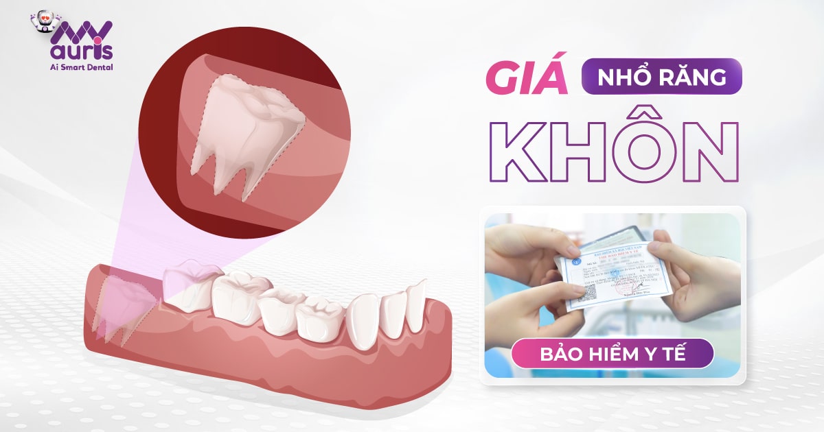 Giá nhổ răng khôn bảo hiểm y tế - 4 yếu tố ảnh hưởng