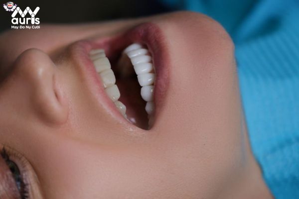 Các ưu điểm của dòng răng sứ Dmag mang lại
