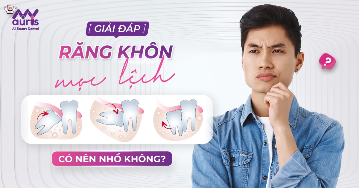 [GIẢI ĐÁP] Răng khôn mọc lệch có nên nhổ không?