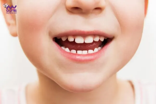Trẻ bị sâu răng hàm có mọc lại không?