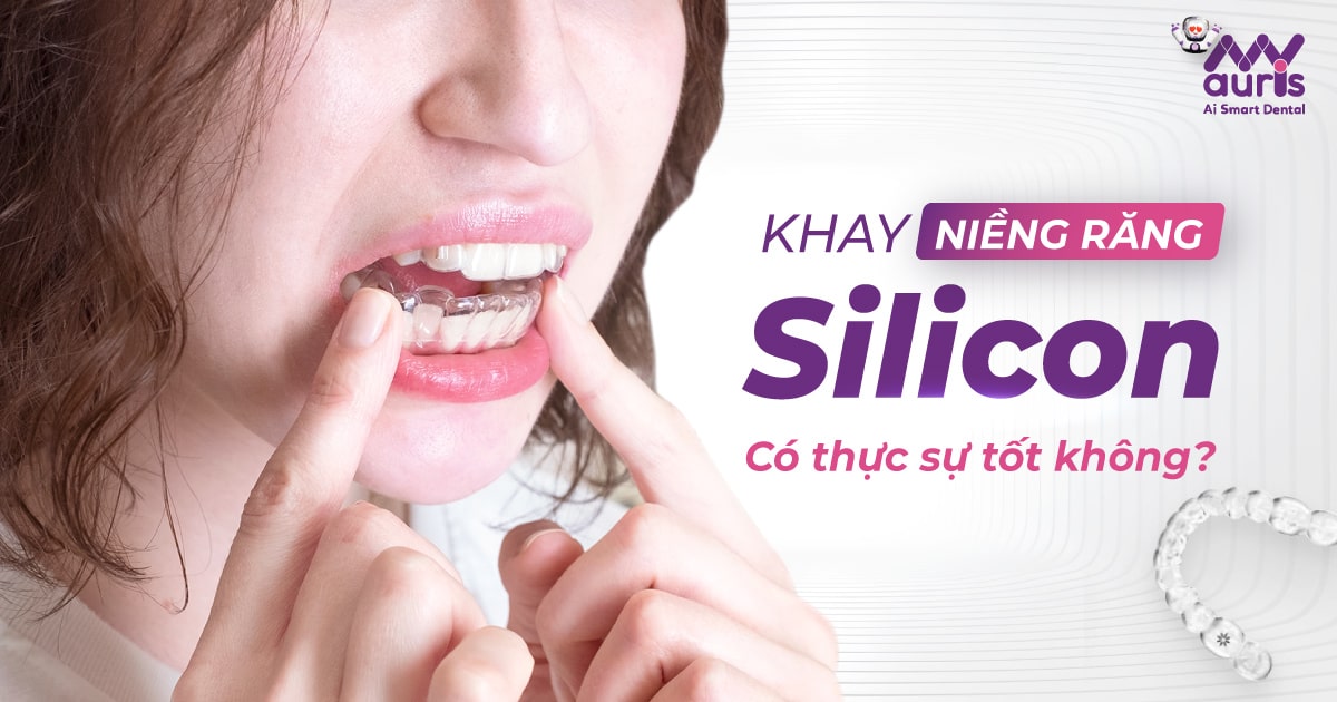 Khay niềng răng silicon có thực sự tốt không?