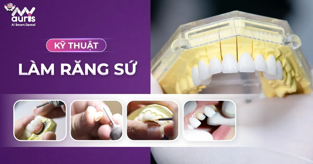 Kỹ thuật làm răng sứ - 5 bước thực hiện an toàn