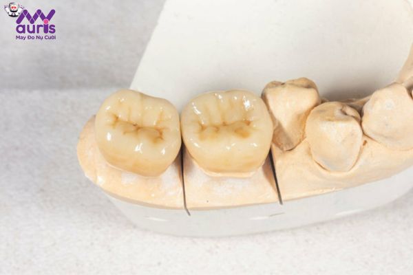 Tìm hiểu làm răng sứ titan có tốt không?