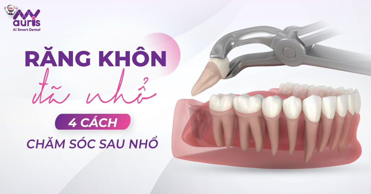 Răng khôn đã nhổ và 4 cách chăm sóc sau nhổ