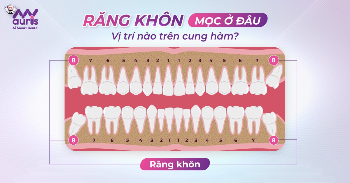 Răng khôn mọc ở đâu