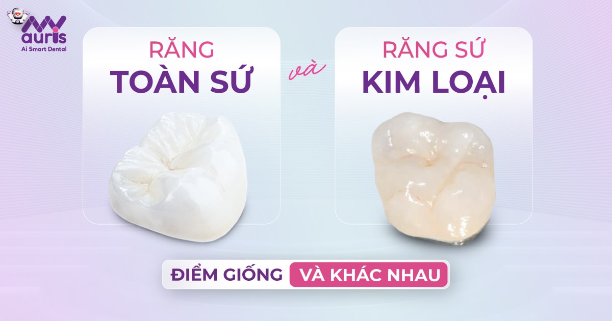 Răng toàn sứ và răng sứ kim loại - Điểm giống và khác