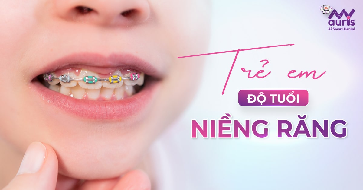 Thời điểm niềng răng tốt nhất với 2 phương pháp chính