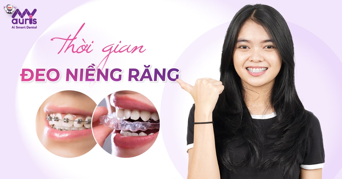 Thời gian đeo niềng răng bao lâu? (2 đối tượng chính)